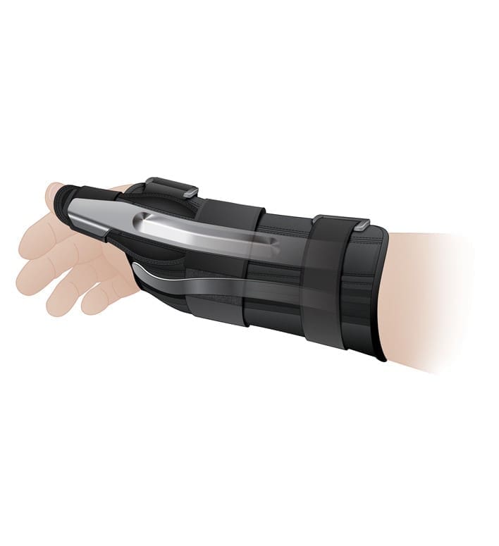 AirCast A2 Wrist Brace with Abduction Thumb Spica - Image 3