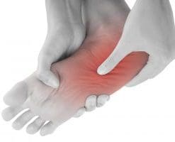 Arch Pain