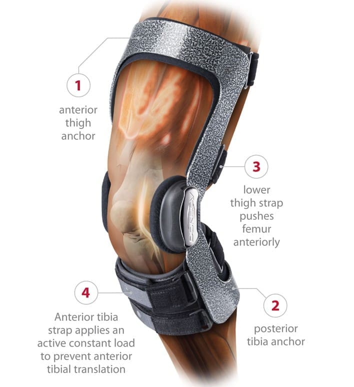 DonJoy ARMOR FourcePoint Knee Brace - Image 5