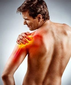 Shoulder Dislocation
